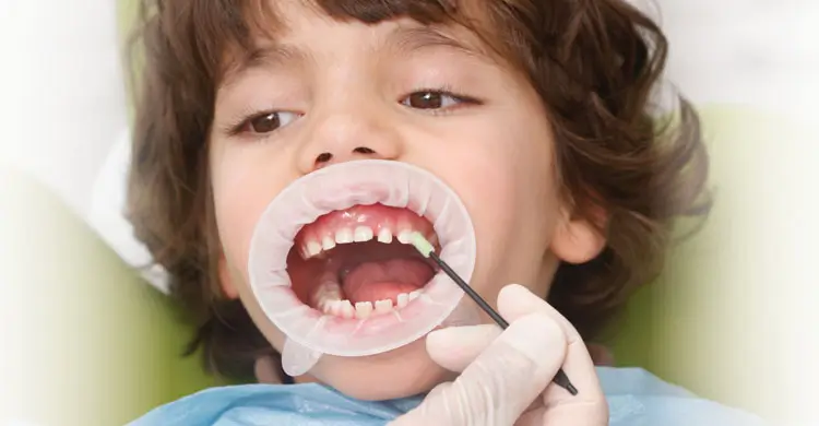 Children's Dentistry Services