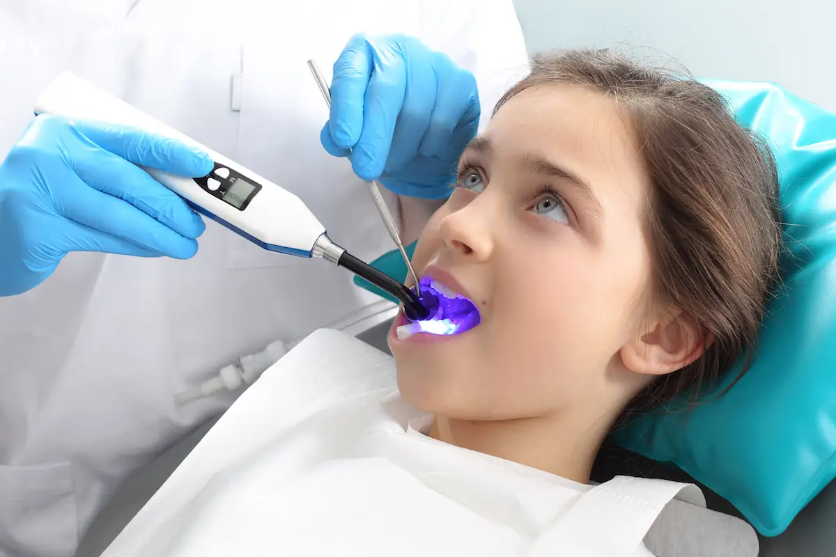 fissure sealants