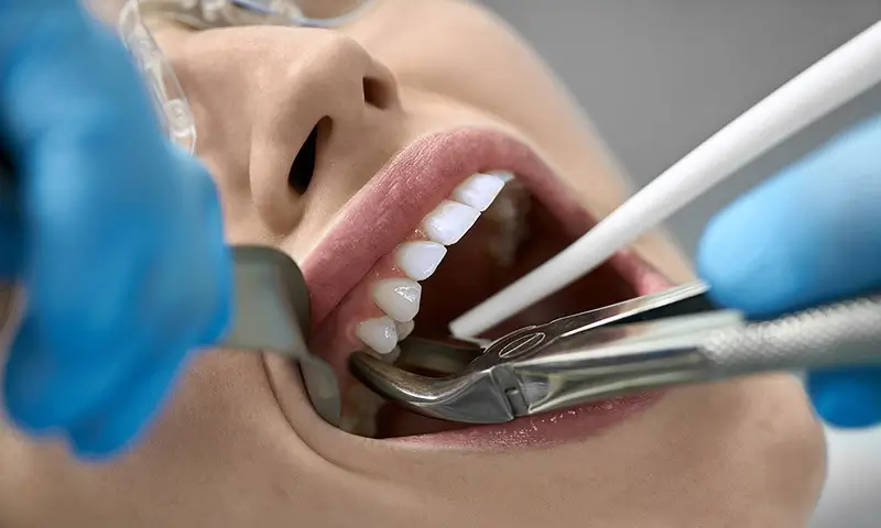Pain and Extractions