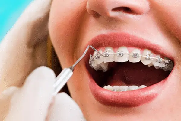 Orthodontics